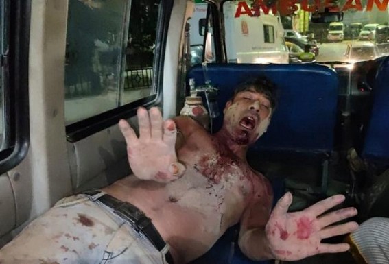 Nesha Mukt Tripura? In inebriated conditions, a Bloody fight occurred among people at gambling Point in Joynagar, Mahabir Club area Nesha Mukt Tripura? In inebriated conditions, a Bloody fight occurred among people at gambling Point in Joynagar, Mahabir Club area